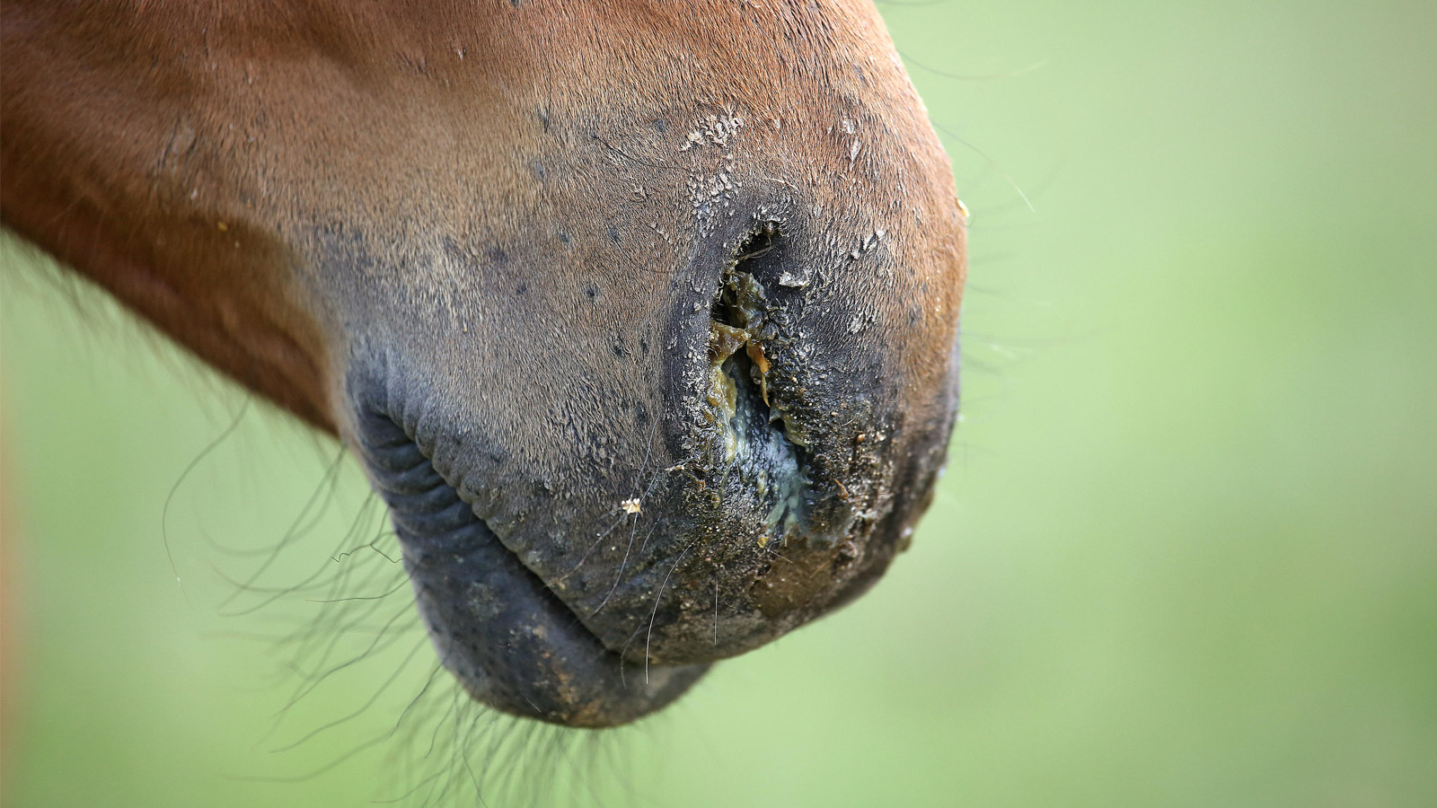 SINUSITIS: NOT TO BE SNEEZED AT